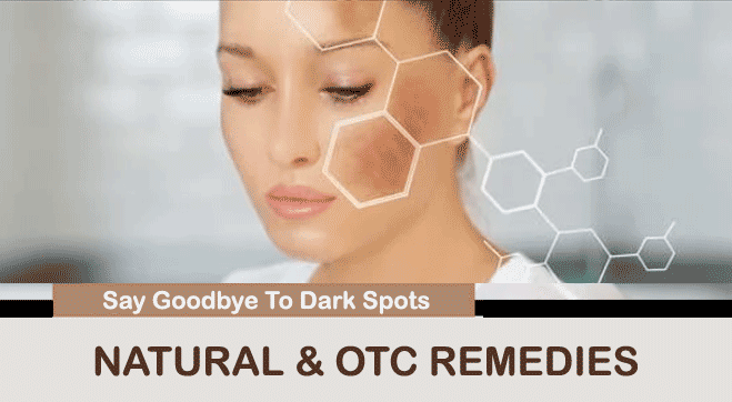 remove dark spots on face