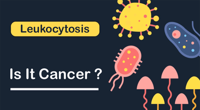 Leukocytosis: Causes, Symptoms, and Treatment | Is It Linked to Cancer?