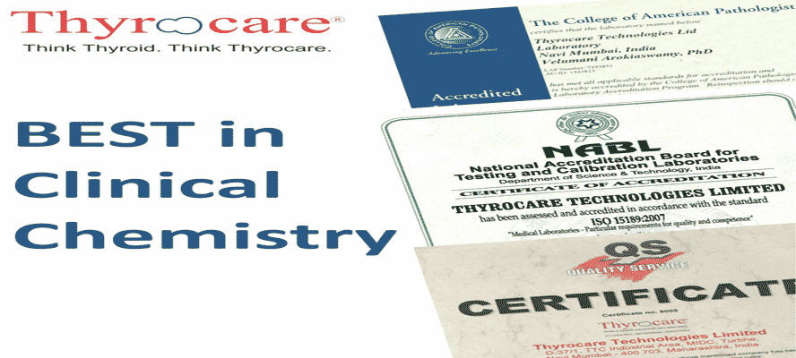 what-are-quality-standards-in-thyrocare-testing-service-health-tips-blog