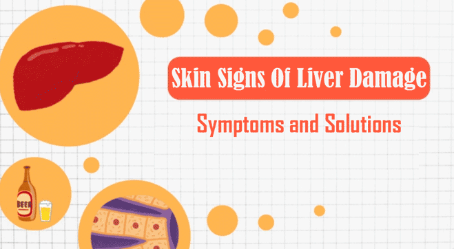 Skin Signs of Liver Damage: Symptoms, Causes, and Solutions Explained